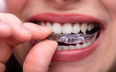 Clear Aligners vs. Traditional Braces: Which Is Right For You?